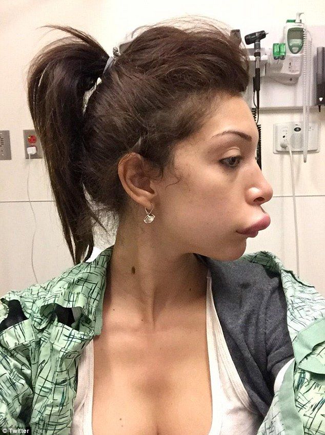 farrah-abraham-lips-1