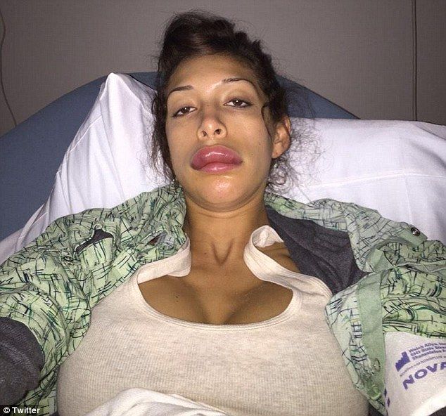 farrah-abraham-lips-