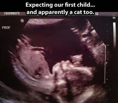 Funny Pictures sonogram cat