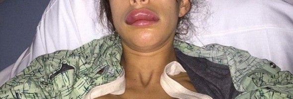 farrah-abraham-lips-